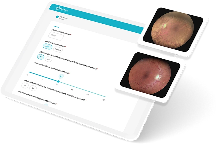 evaluacion_retinia_paso1