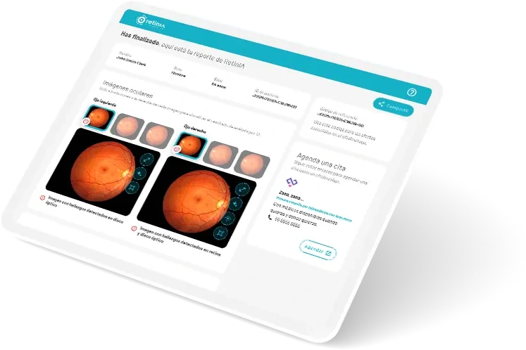 evaluacion_retinia_paso2